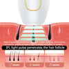 SmoothChic InfinityGlide™ Laser Hair Removal Device